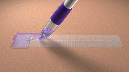 DERMABOND PRINEO Skin Closure System
